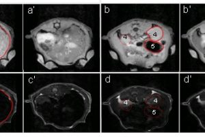 Nuevas nanopartículas para facilitar el diagnóstico clínico mediante la mejora del contraste en imágenes de resonancia magnética